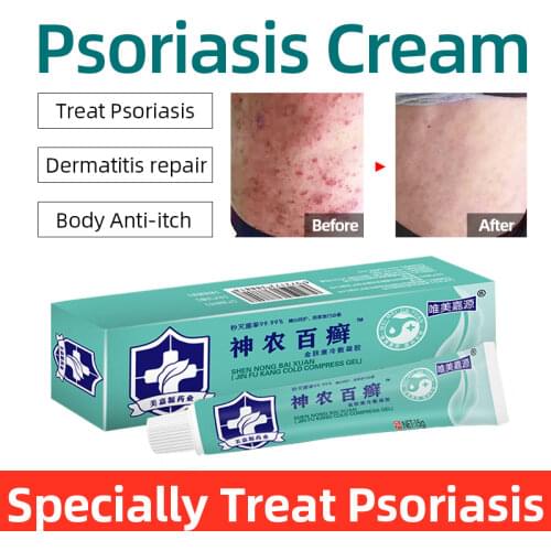 Shennong Psoriasis Ointment 99.99% Antibacterial Dermatitis Treatment Cream Work For Eczema Lichen Planus Herbal Care