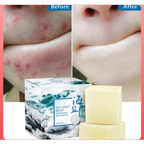 100g Sea Salt Soap Removal Pimple Pore Acne Treatment Sea Salt Soap Moisturizing Goat Milk Soap Base Skin Care Soap