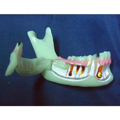 Advanced Simulation Model of Mandibular Tissue Decomposition,Simulation Model of Mandibular Structures