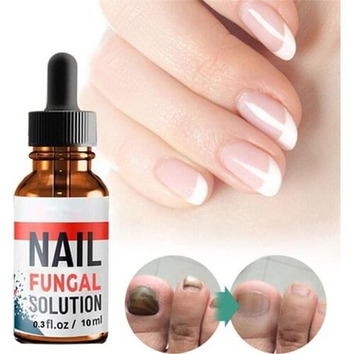 30/20/10ml Foot Anti-fungal To Remove Onychomycosis Repair Treatment Liquid Healthy Nail Care Repair Liquid