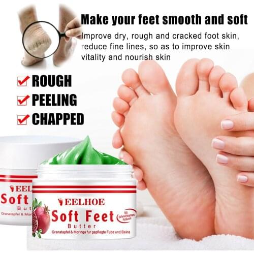 Moisturising Treatment Cream with Vitamin E for Hand Foot Anti-cracking Dry Cracked Moisturizing Foot Hand Care Lotion