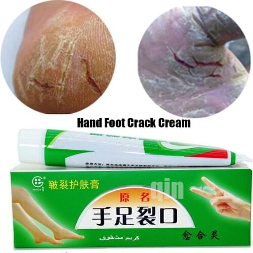 Natural Chinese Cosmetics Hand Foot Crack Cream Peeling Repair Heel Chapped Anti Dry Crack Ointment Exfoliating Foot Cream