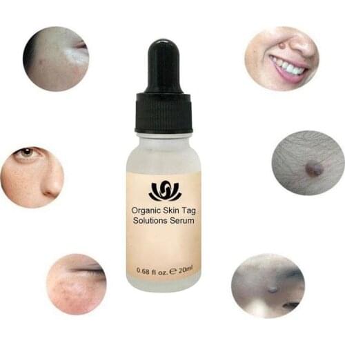 Newstly Mighty Tag & Spots Remover Serum Painless Mole Skin Dark Spot Mole Removal Face Wart Tag Freckle Skin Tag Removal Cream
