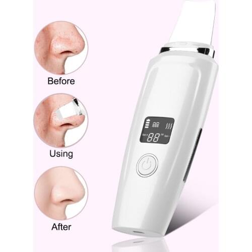 Ultrasonic Skin Scrubber USB Deep Face Cleaning Machine Peeling Shovel Facial Pore Cleaner Face Skin Scrubber Lift Machine