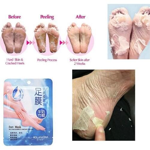 2Pcs=1Packs Milk Bamboo Vinegar Foot Care Peeling Feet Mask Real Remove Callus Dead Skin Pedicure
