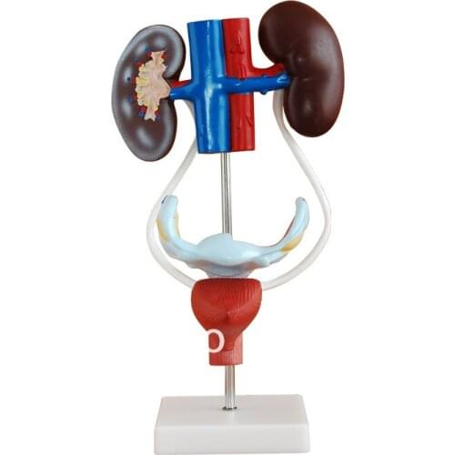 Female Urogenital System,Female Urogenital System Anatomical Model