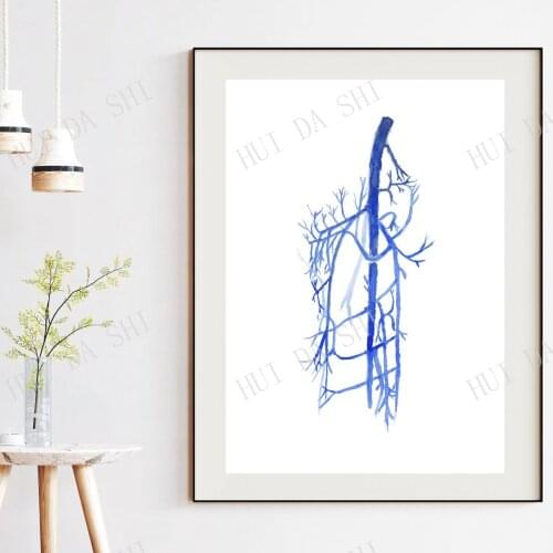 External Iliac, Femoral, Saphenous Vein Anatomy, Lower Limb Anatomy, Venography, Phlebography, Varicectomy