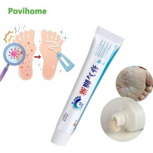 3pcs 25ml Herbal Foot Treatment Anti Fungal Infection Onychomycosis Paronychia Removal Odor Toe Fungus Treatment Foot Care P1278