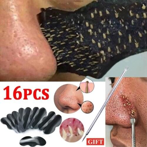 15+1pcs/set Nose Blackhead Remover Mask Neddles Pore Cleaner Acne Facial Cleanser Pimple Spot Extractor Beauty Tools Skin Care