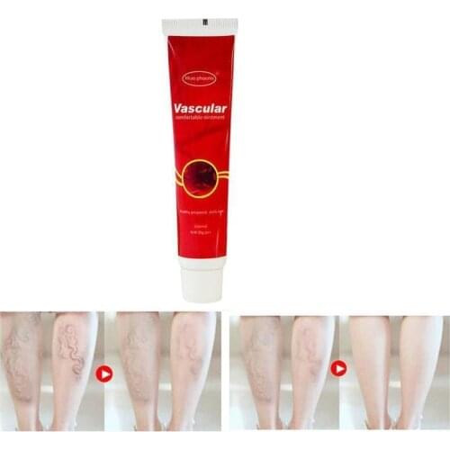 1 Varicose Veins Treatment Cream Varicosity Angiitis Remedy Ointment Relief Veins Pain Phlebitis legs Varicose Veins Cream