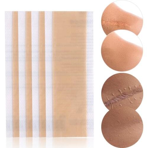 Silicone Scar Patch Sheets Remove Trauma Burn Scar Sheet Skin Repair Scar Removal Therapy Patches Silicone Acne Scar Treatment