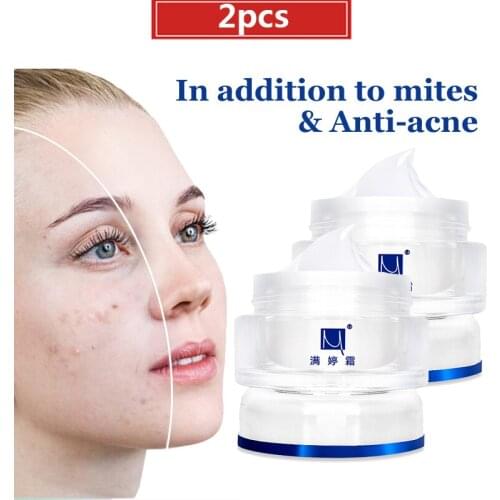2pcs ManTing Cream Body and Face Whitening Mite Bug Busters Acne Treatment Scars Ance Remover Cream Removing Blain Accusing Oil