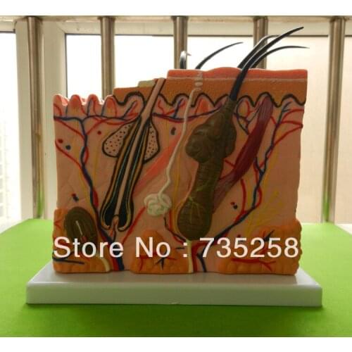 Enlarged Skin Model,Skin Enlarge Anatomical Model