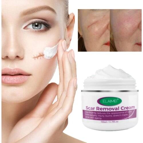 Removal Scar Cream Face Pimples Scar Stretch Marks Removal Acne Treatment Whitening Moisturizing Cream Skin Care TSLM1