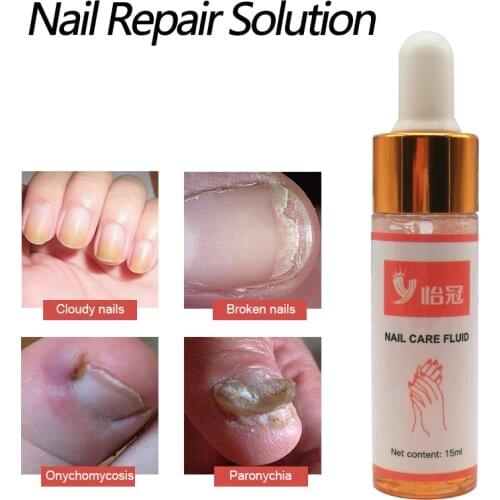 Nail Repair Solution Treatment Onychomycosis Paronychia Anti-Fungal Nail Infection Herbal Fungus Repair Essence Care
