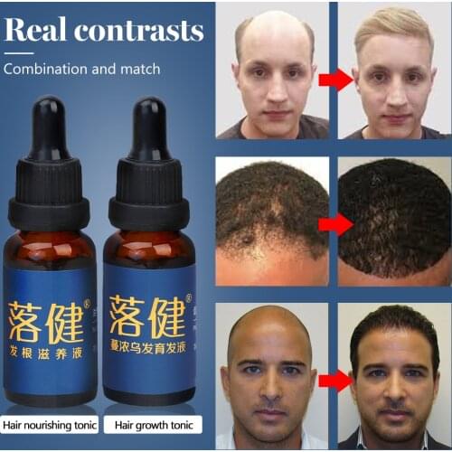 Hair Care Hair Growth Essential Oil Essence Hair Loss Liquid Treatment Health Care Beauty Dense Hair Growth Serum for Men Women