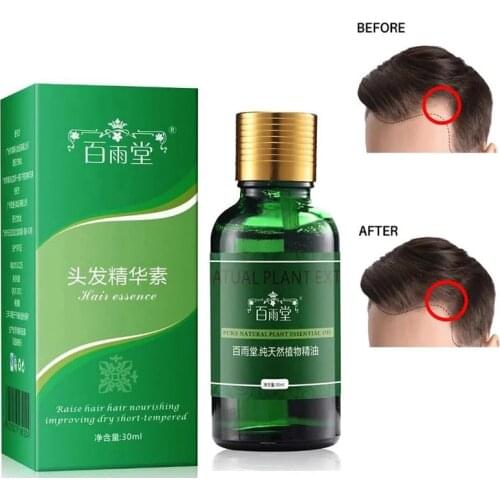 Hair Care Hair Growth Essential Oils Essence Original Authentic 100% Hair Loss Liquid Health Care Beauty Dense Hair Growth Serum