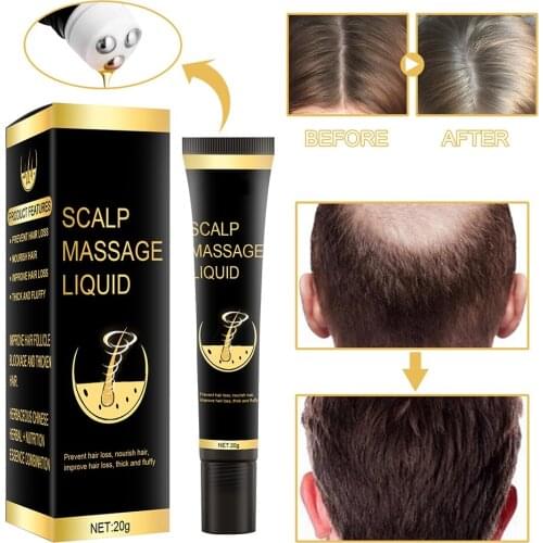Roller Scalp Massage Hair Growth Oil Thickener Essence Treatments Fast Grow Hair Serum Anti Hair Loss