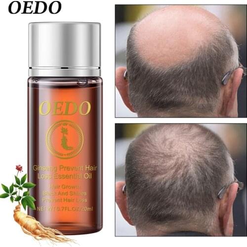 20ml Ginseng Hair Growth Essence Oil Prevent Hair Loss Scalp Repair Damage Hair Nourish Hair Roots Accelerate Hair Growth Serum