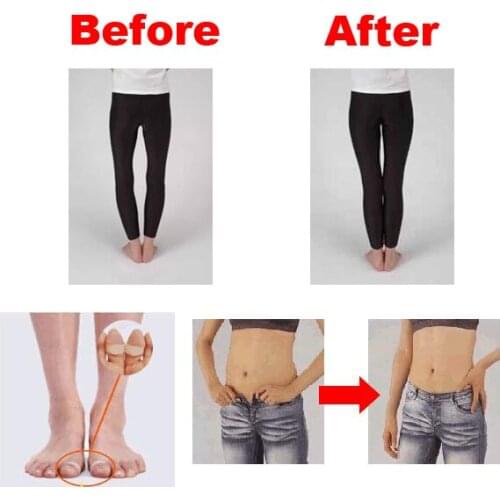 1 Pair/ 2 Pair/ 5 Pair Slimming Silicone Magnetic Toe Ring for Weight Loss Keeping Fit SDFA88