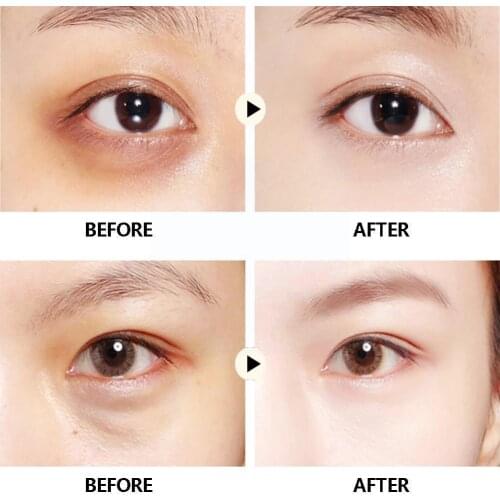 Panda Starry Eye Mask Hydrating Moisturizing And Improving Eye Circles Lines Starry Mask Dark Fine W9D9