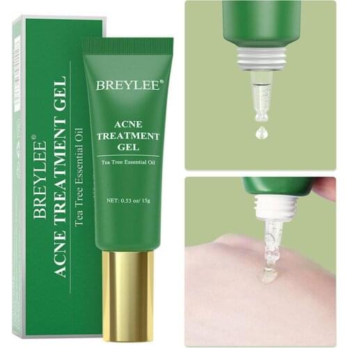 15g Acne Treatment Gel Cream Eliminate Acne Removal Oil Control Moisturizer Repair Spot Shrink Pores Anti Acne Serum Skin Care