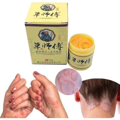 Dermatitis Eczematoin Eczema Psoriasis Cream Ointment Skin Cream