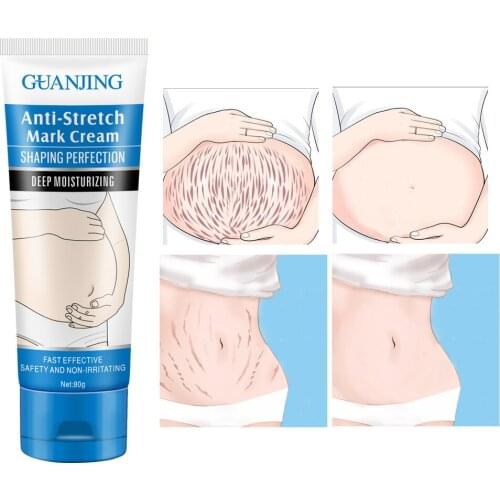 80g Stretch Mark Skin Cream Removes Maternal Skin Repair Body Cream Removes Postpartum Scar Care Gentle Moisturizing Beauty Care