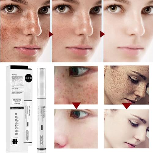 Strong Whitening Cream Freckle Cream Remove Melasma Acne Dark Pigment Spots Melanin Pimple Cream Face Brightening skin Care