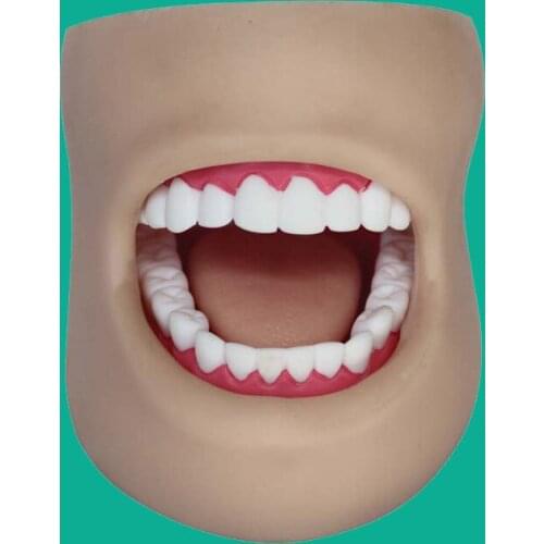 HOT Dental Care Model With Cheek