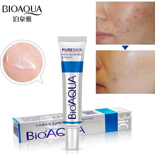 BIOAQUA Face care Acne Treatment Acne Treatment Cream Shrink pores Oil Control Skin care 2pcs 60g