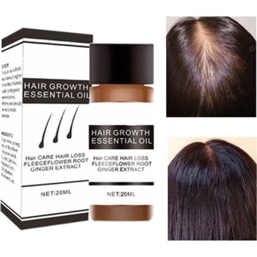 Okenys Fast Hair Growth serum ginger Essence for Women,anti Hair Loss Liquid damaged Hair Repair Growing Faster,Repair hair