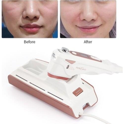MINI HIFU Multifunctional Skin Care Ultrasonic Facial Beauty Instrument Facial Lifting Rejuvenation Anti Aging Wrinkle Remove