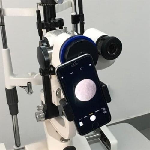 Smartphone Slit Lamp Operating Microscope Camera Adapter