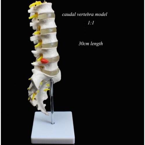 Medical use teaching Lumbar vertebra natural 1:1 adult caudal vertabra model orthopedics model umbar disc herniation model 30cm