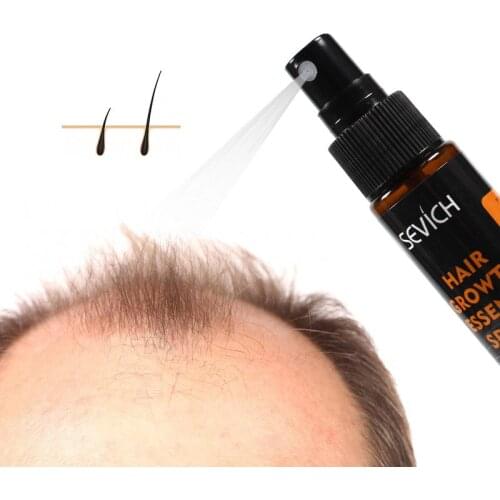 30ml Hair Growth Oil Spray Hair Lose Liquid Portable Repair Growing Home Easy Original Men Women Hair Loss Product Series