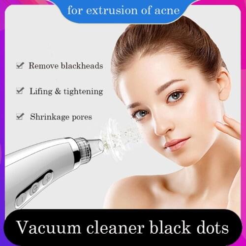 Black Points Vacuum Face Cleaning Device from Black Dots for Extrusion of Acne Comedones Suction Blackheads Against Sucker Clove