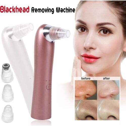 Facial Blackhead Remover Skin Care Electric Acne Cleaner Pimple Removal Shrink Pores Machine USB Rechargeable Face Cleaner Tool