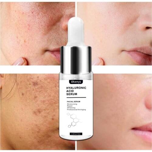 15ml Hyaluronic Acid Face Serum Moisturizing Whitening Facial Essence Face Cream Repair Anti Aging Lifting Firming Skin Care