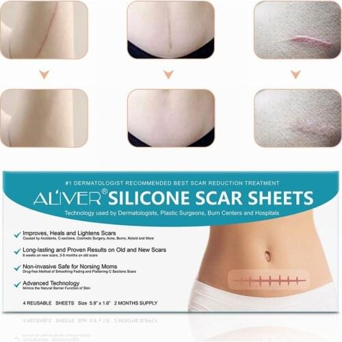 4 Slices Remove Trauma Burn Sheet Skin Repair Waterproof Silicon Patch Reusable Silicone Scar Sheets Removal Patch Acne Gel Scar