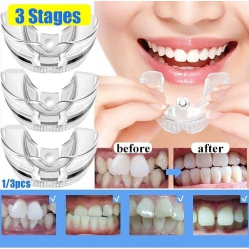 Dental Orthodontic Teeth Corrector Silicone Braces Retainer Straighten Tools Teeth Capped for Adults Tooth Care Tools 3 Phases