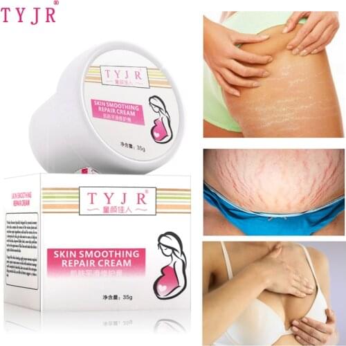 35G Effectively Repair Stretch Marks Removal Remover Plant Natural Heal Pregnancy Breast Hip Legs Stretch Mark Cream