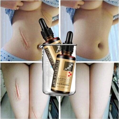 Essential Massage Oil Scar Removal Lavender Repair Essence For Pregnant Women Hyaluronic Acid Serum Oil Essential Face Anti Acne