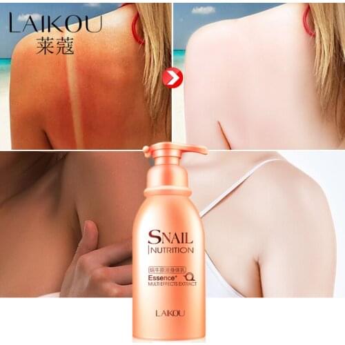 LAIKOU Snail Extract Wrinkle Body Cream Moisturizing Lotion Moisturizing Body Cream Rough Anti-Aging Skin Care Whiteing Cream