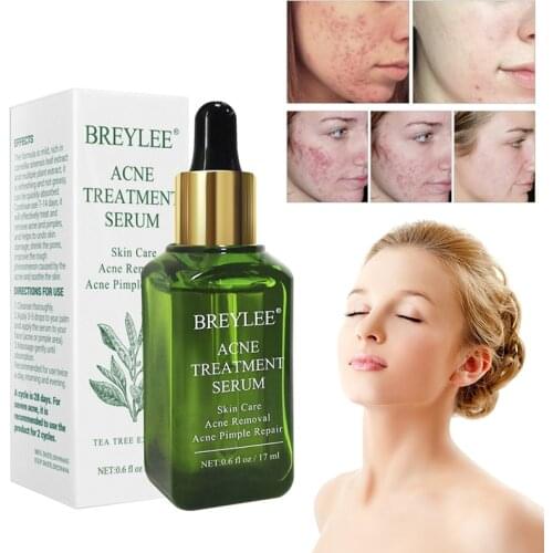 Face Serum Anti-acne Scar Removal Anti-Aging Acne Care Cream Skin Repair Lasting Moisturizing Facial Skin Care TSLM1