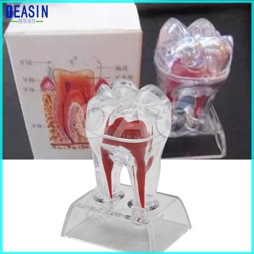 Dental teeth model Crystal Base Hard Plastic Teeth Tooth Molar Model Fit for Smile