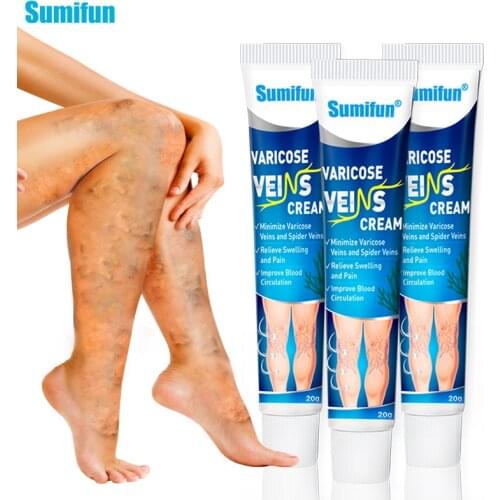 1/3pcs 100% Original Varicose Veins Ointmnet Vasculitis Phlebitis Spider Pain Relief Ointment Medical Plaster Angiitis Removal