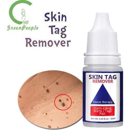 10ml Genital Wart Treatment Papillomas Removal Of Warts Liquid From Skin Tags Removing Against Moles Remover Anti Verruca