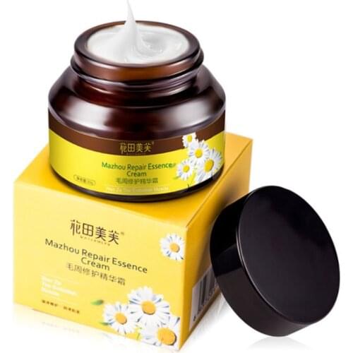30g Facial Body Ichthyosis Anti-Wrinkle Treatment Repair Essence Cream Curing Chicken Fish Scale Snake Skin Anti Aging Lotion