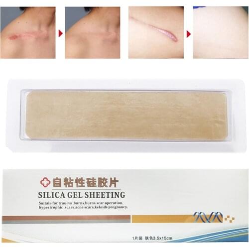 1 Pcs Silica Gel Sheeting Scar Removal Sheet Therapy Patch for Trauma Acne Pregnancy Scar SN-Hot